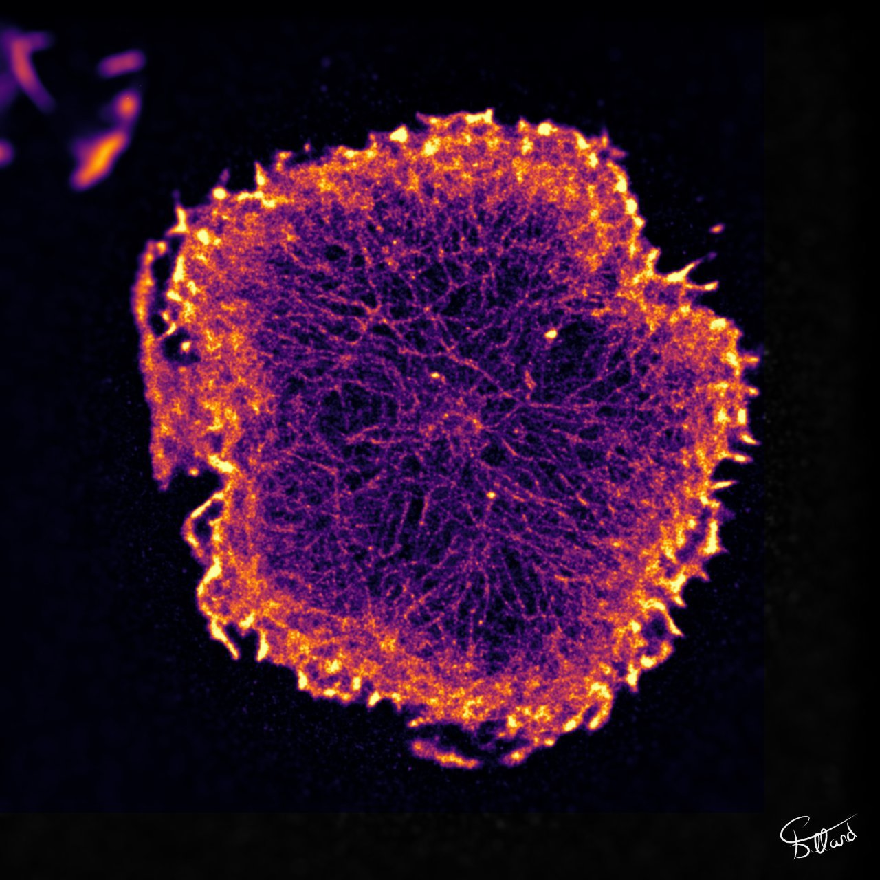 This is a T cell, or more precisely, an actin cytoskeleton of a T lymphocyte. The picture is obtained by a special micro- scope. The cell’s size: 38*38 μm. Photo: Pierre Dillard