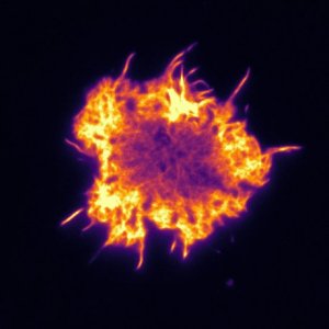Micrograph of actin cytoskeleton of T-cells. The cell is about 10µm in diameter. Photo: Pierre Dillard