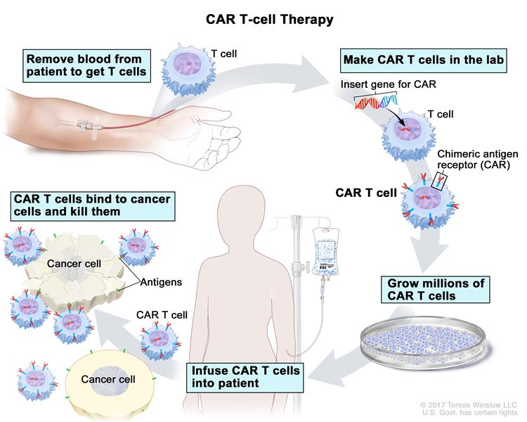 Image describing CAR T cell therapy.