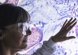En forsker undersøker et celler fra en kreftsvulst. Illustrasjonsfoto: AstraZeneca