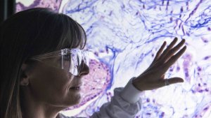 En forsker undersøker et celler fra en kreftsvulst. Illustrasjonsfoto: AstraZeneca 